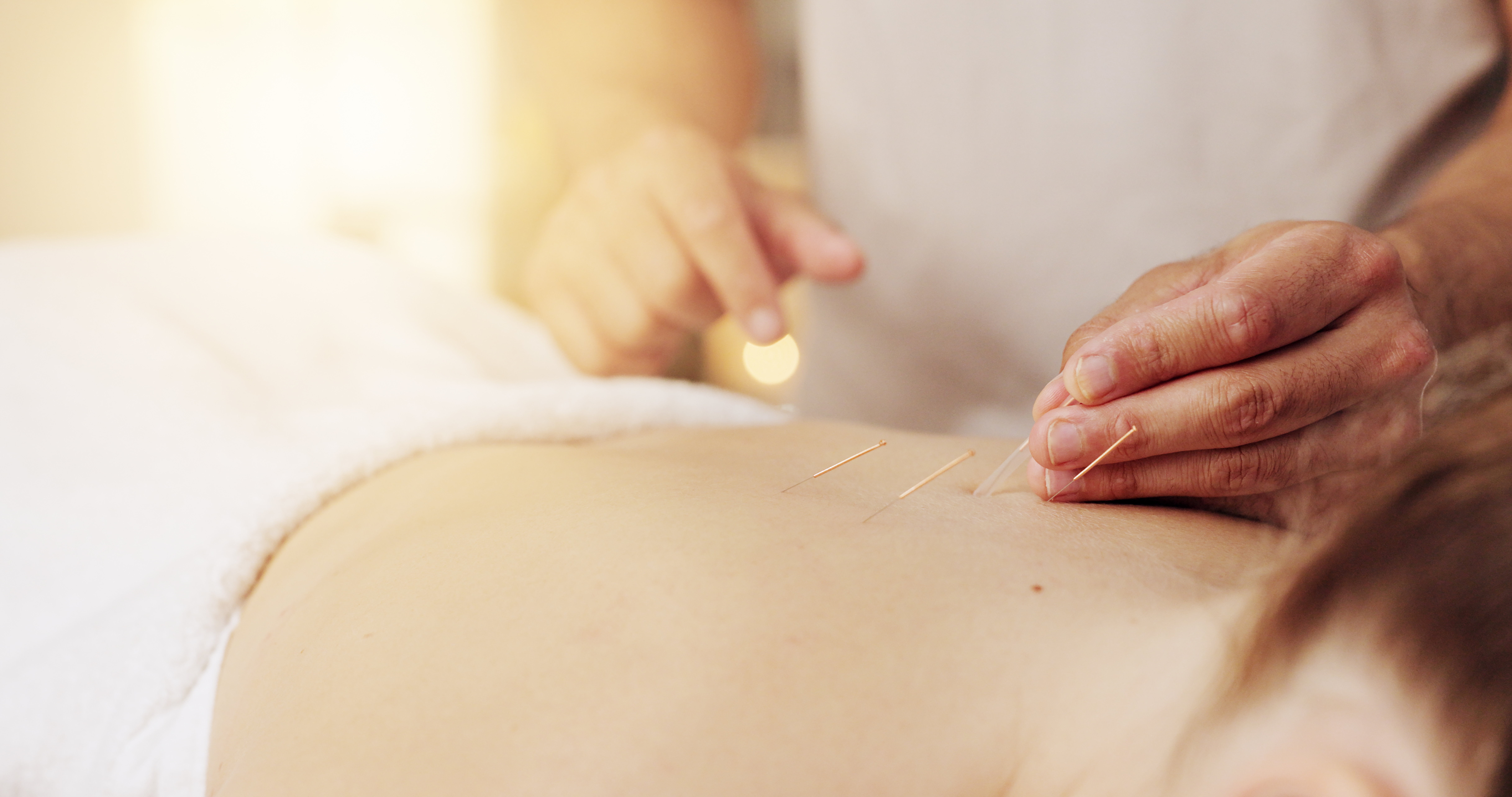 acupuncture hands and stress relief in spa with c 2af6b057e4f9c605a4f1