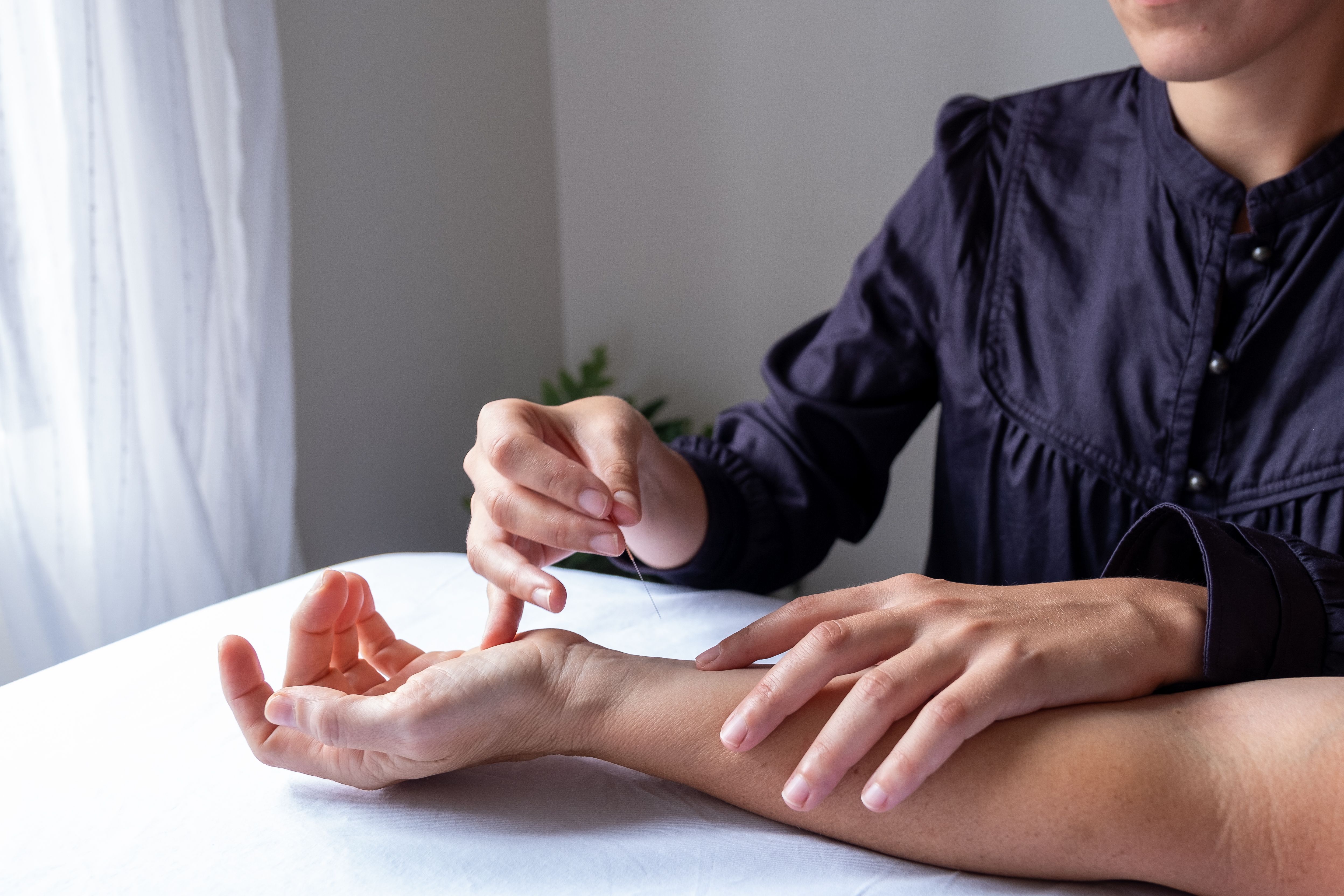acupuncturist performing a treatment on a patient d7cecdaf17f15380fac3