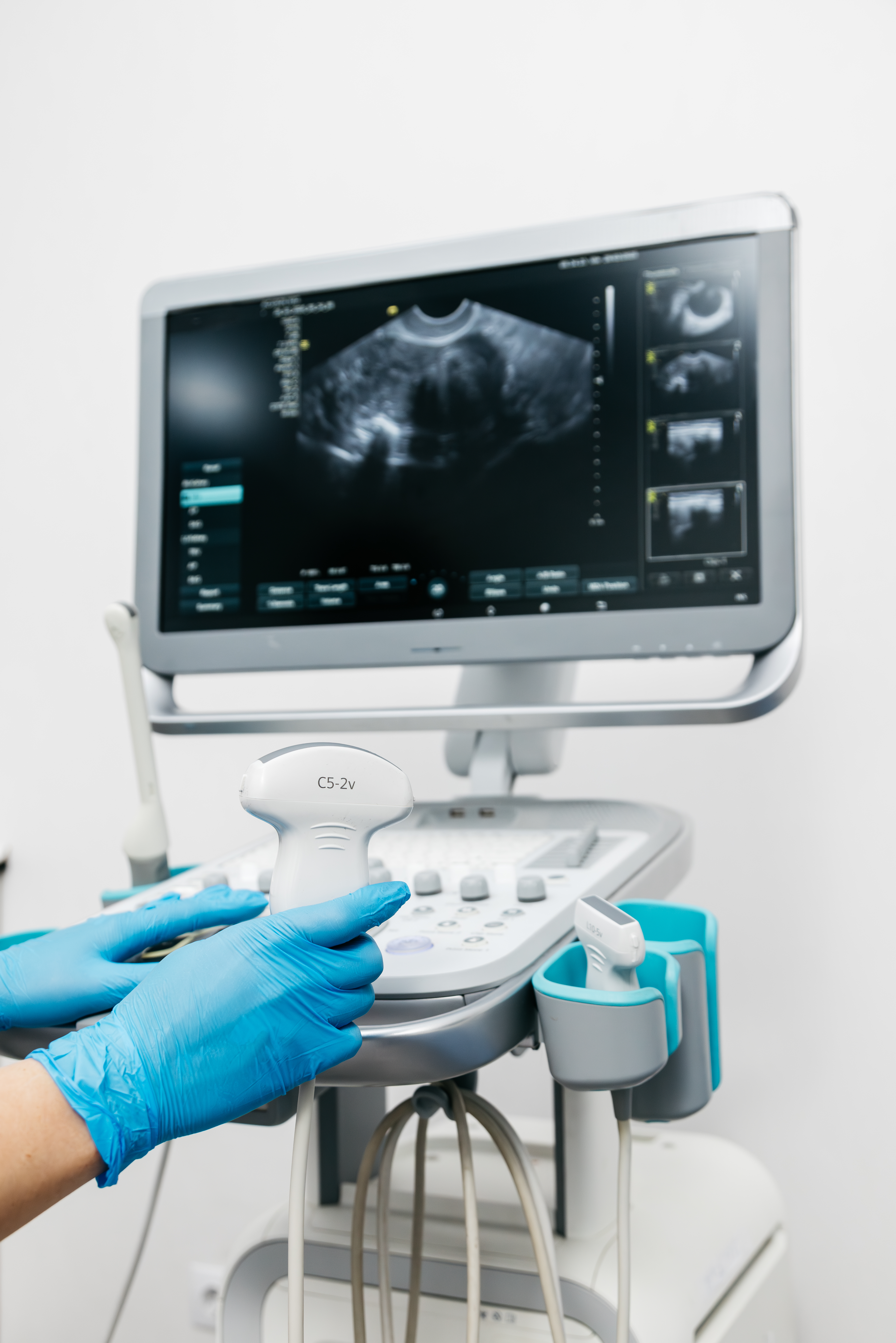 close up of ultrasound equipment with a probe in a e6a4d5eed4aca2264055
