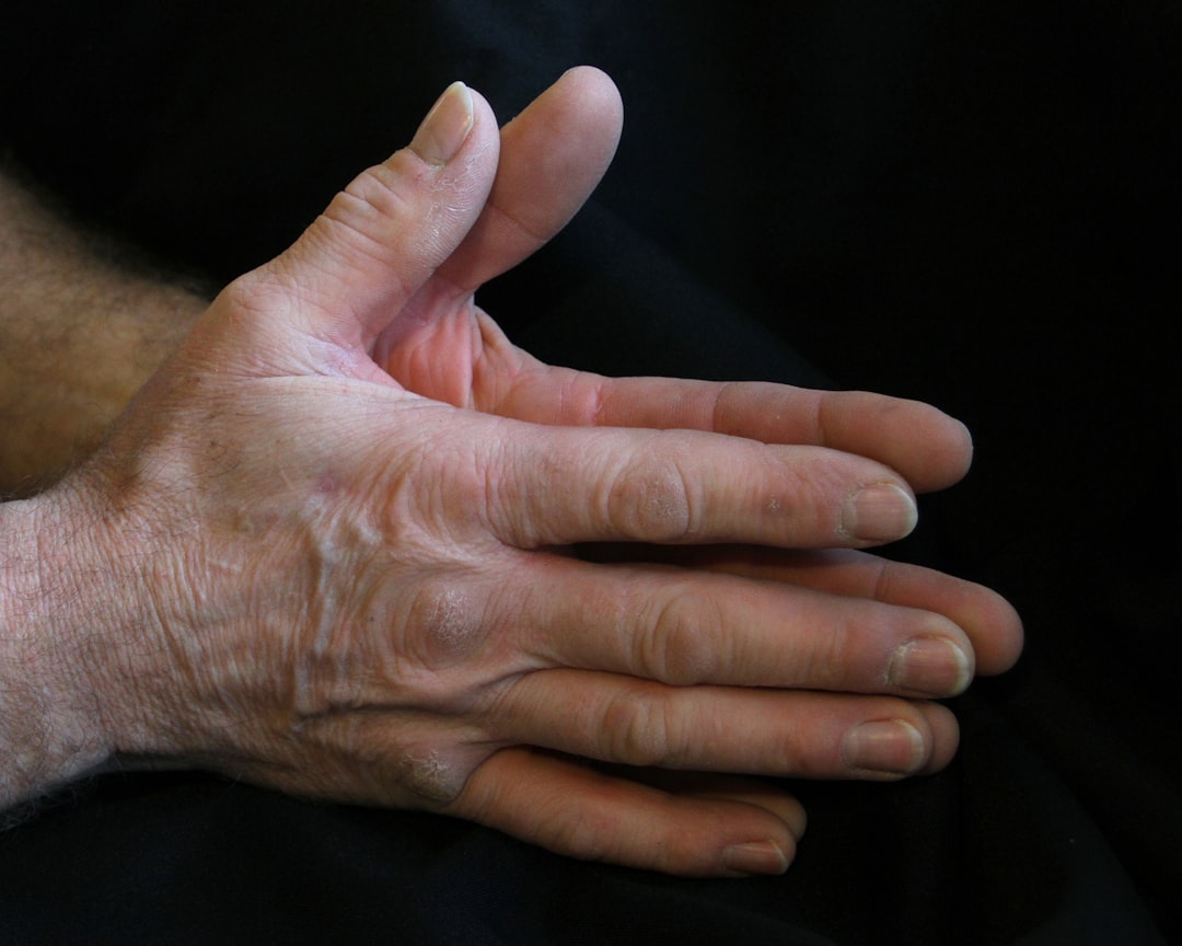 Restoring Function and Confidence after Hand and Wrist fractures