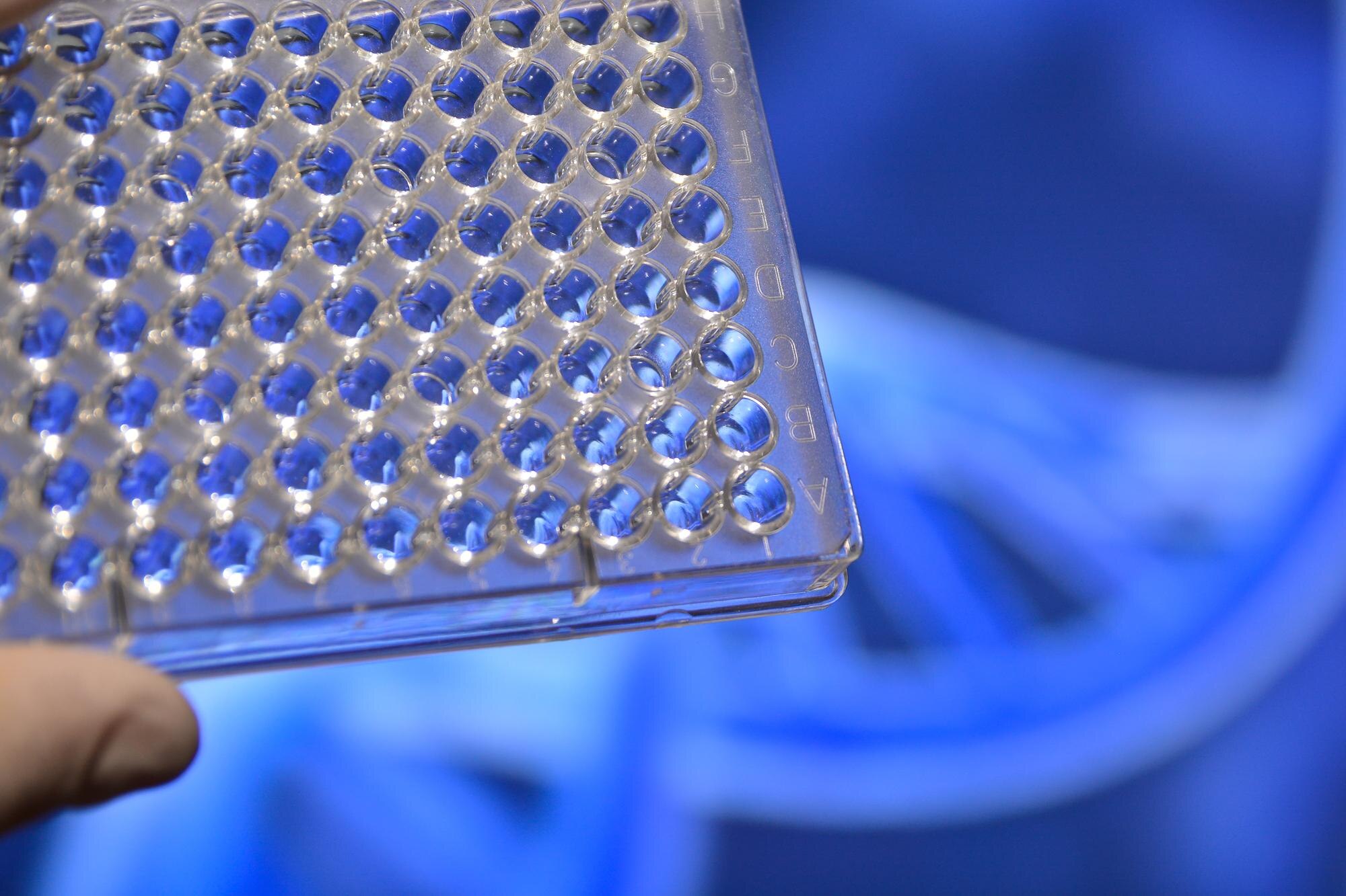 Choosing the Right Plastic for Long-Lasting Performance: A Practical Guide for Trade and DIY 3 in the laboratory of medical genetics 3239a4602c012bfff365