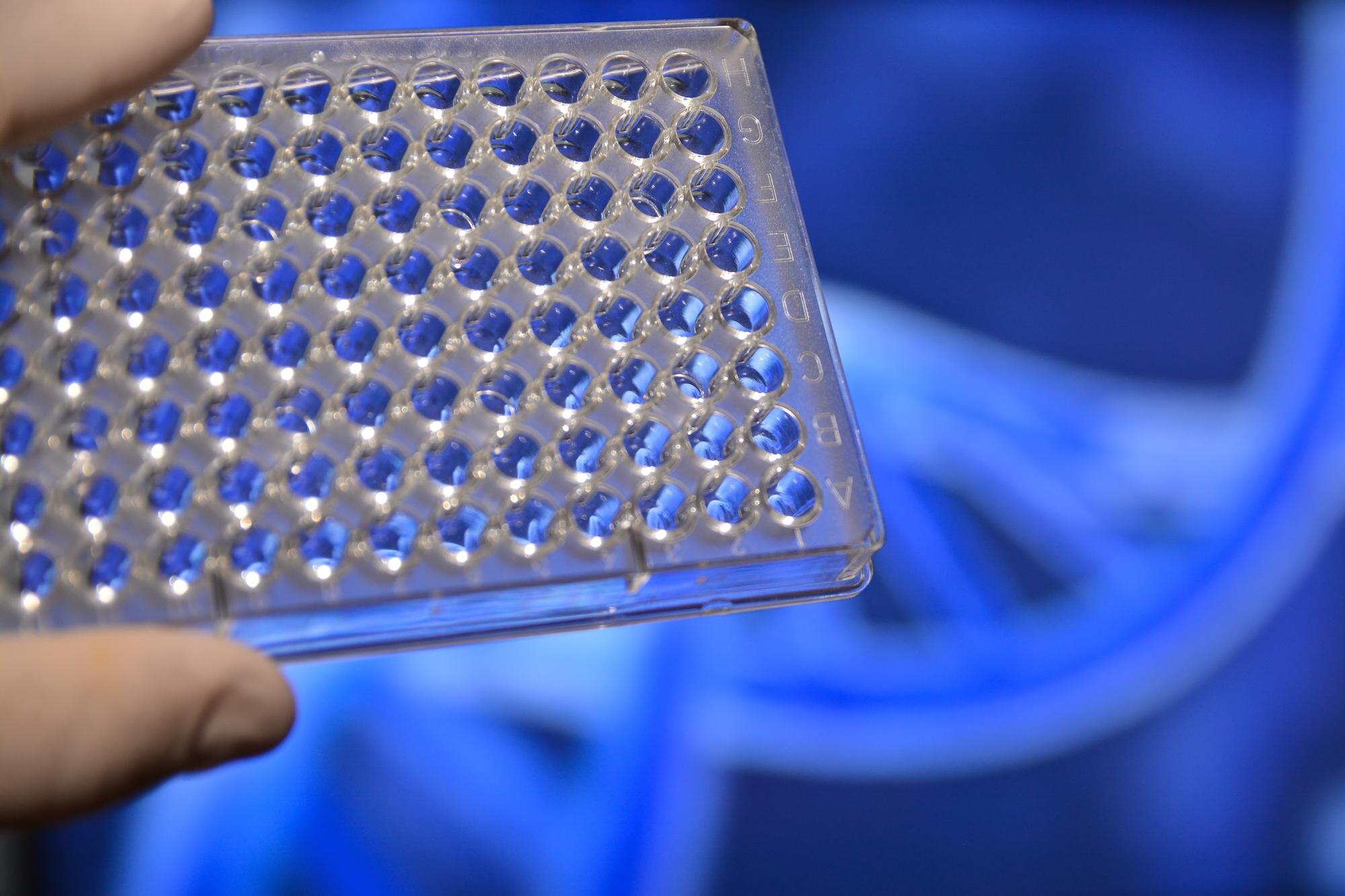 The Ultimate Guide to Choosing the Right Plastic Material for Your Custom Fabrication Project 3 tests in medical science laboratory 86cc8af85891eabe8296