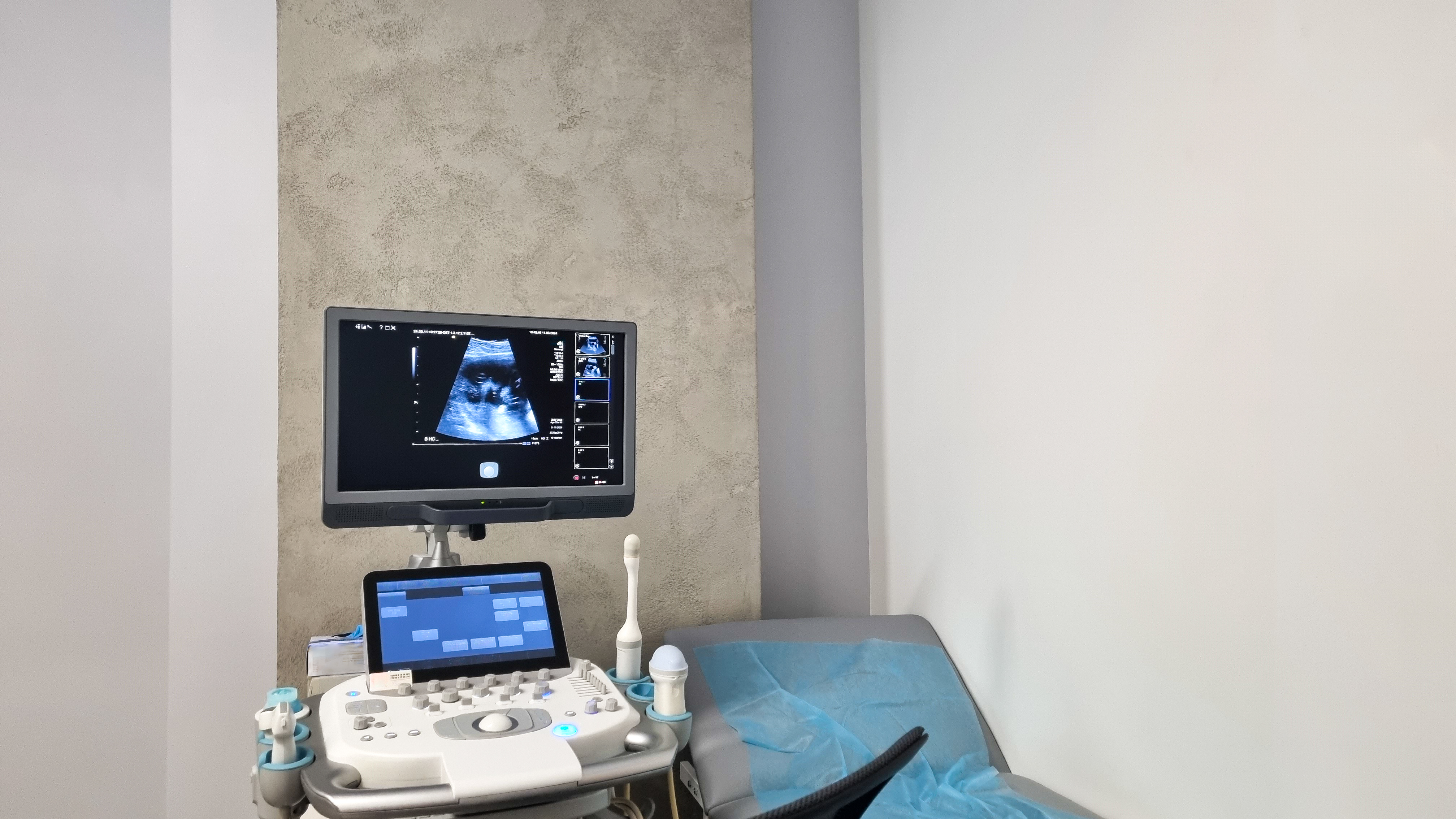 ultrasound monitor with fetus pictures ultrasound 6f23577fbd51e0daee6b