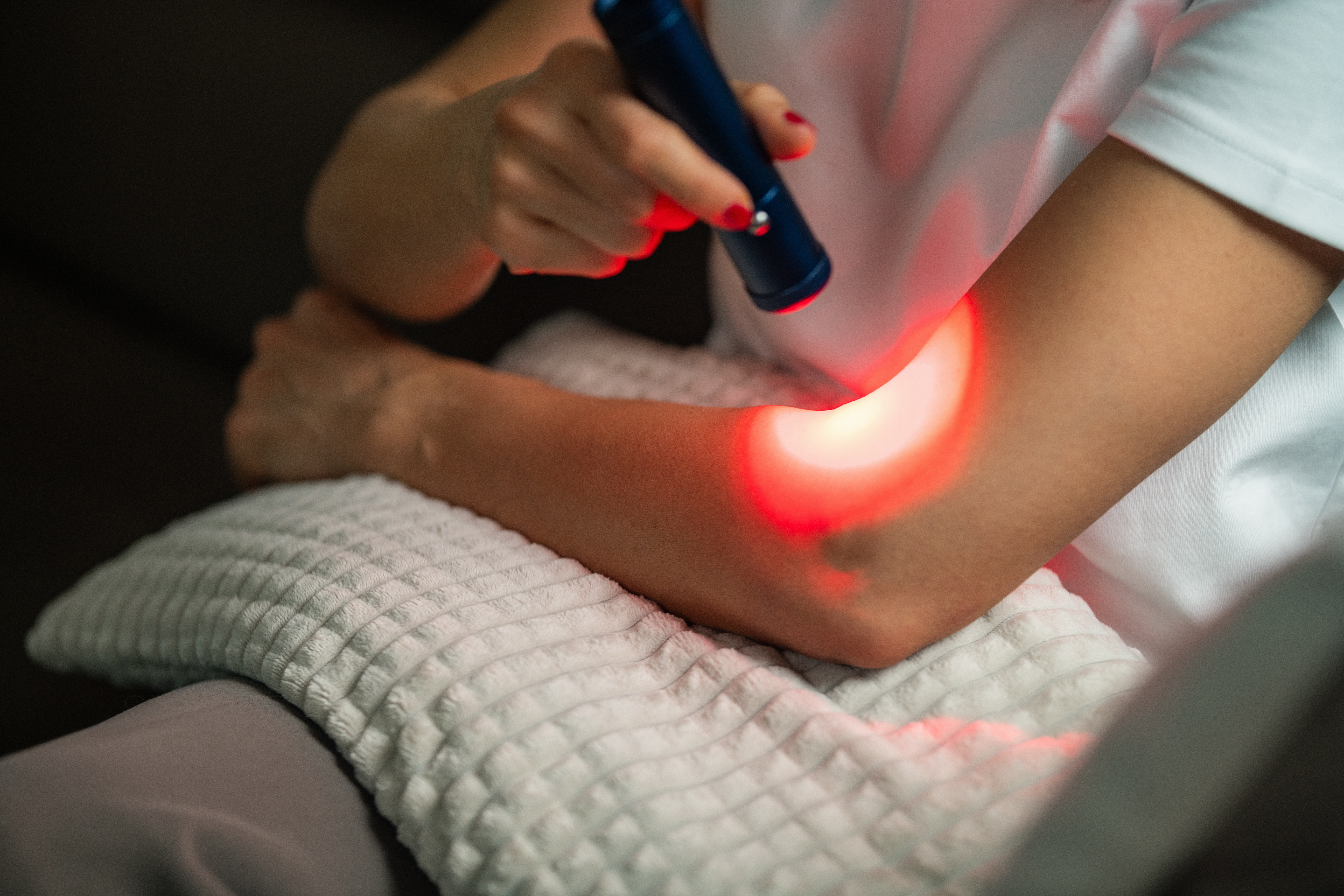 ATP‑Boosting Benefits: How Cold Laser Therapy Biohacks Your Healing in Port Credit 1 using red light therapy on the elbow alleviates pa 49eff7e475623117592e