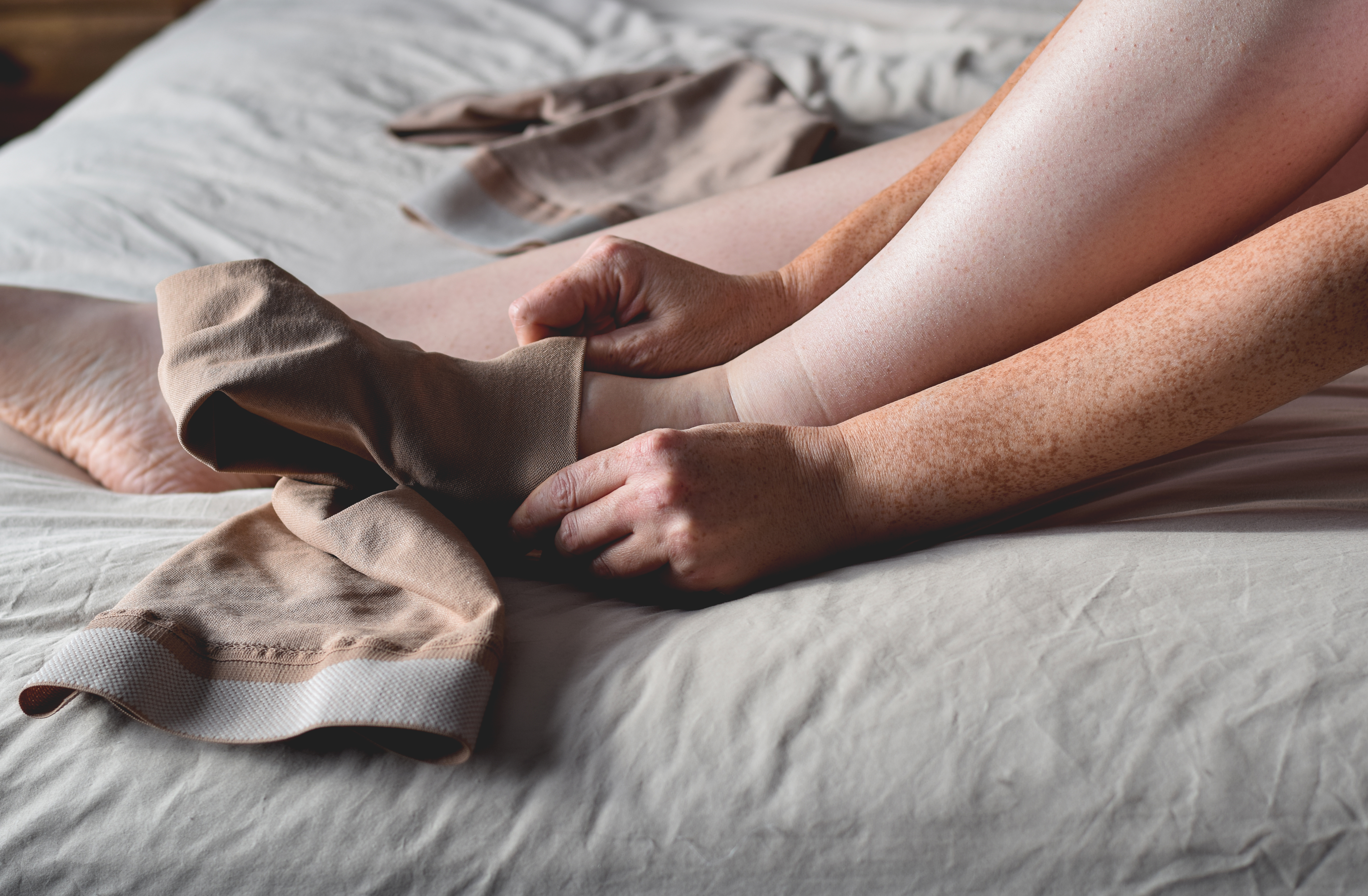 woman putting on compression stockings on swollen 699406abfcef1d442d41